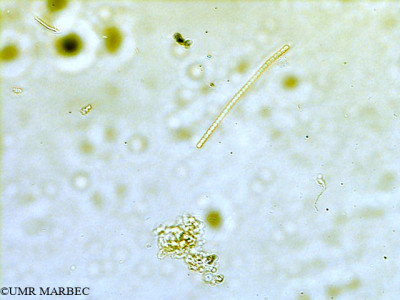 phyto/Scattered_Islands/all/COMMA April 2011/Komvophoron sp1 (2)(copy)_thumb.jpg